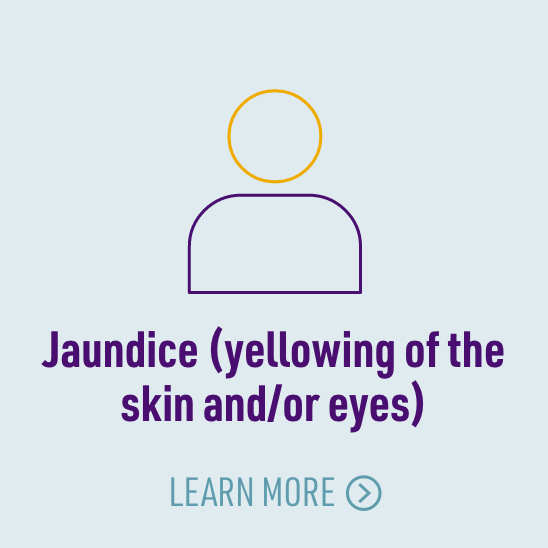 symptom - jaundice icon