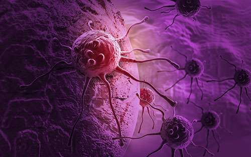 Different types of pancreatic cancer start in different types of cells in the body