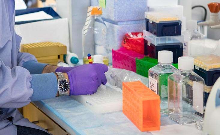 Scientist wearing purple gloves working in a pancreatic cancer early detection laboratory