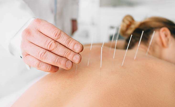 Pancreatic cancer patient attends an acupuncture session to relieve nausea and pain