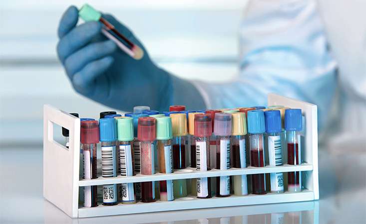Early Detection Blood Tests