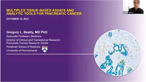 3.Pancreatic cancer physician-scientist studies tumor microenvironment and treatment response 