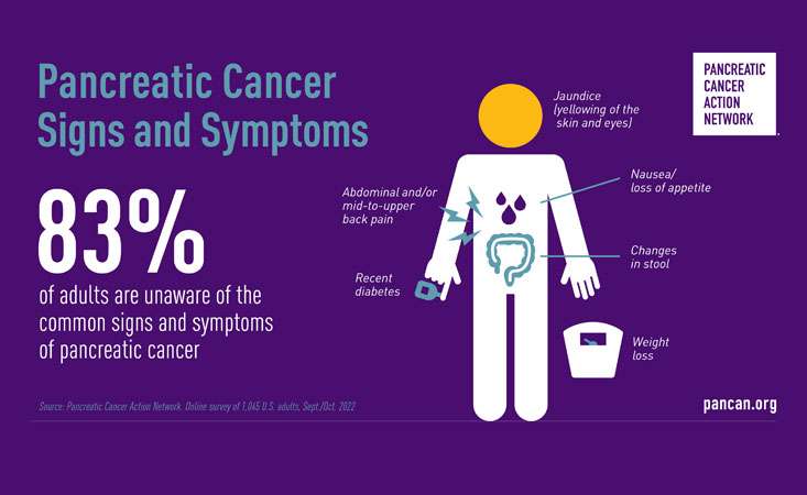 Most U.S. Adults Are Unaware Of The Signs And Symptoms Of Pancreatic ...